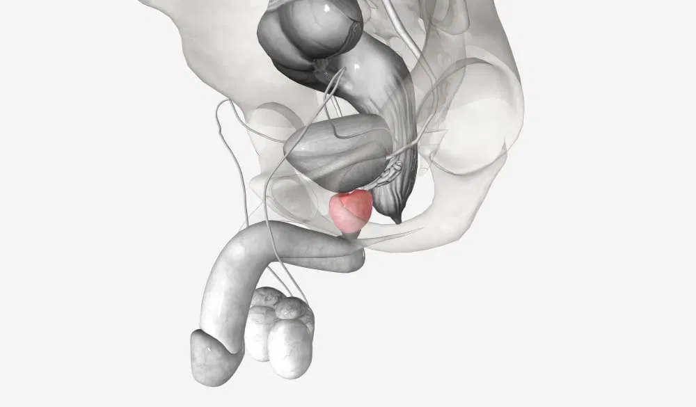 علاج التسرب الوريدي بدون جراحة