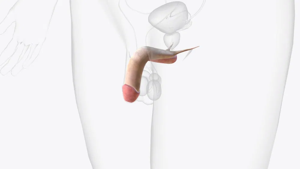 تركيب دعامات للعضو الذكري — ما الذي تحتاج معرفته فعلاً؟