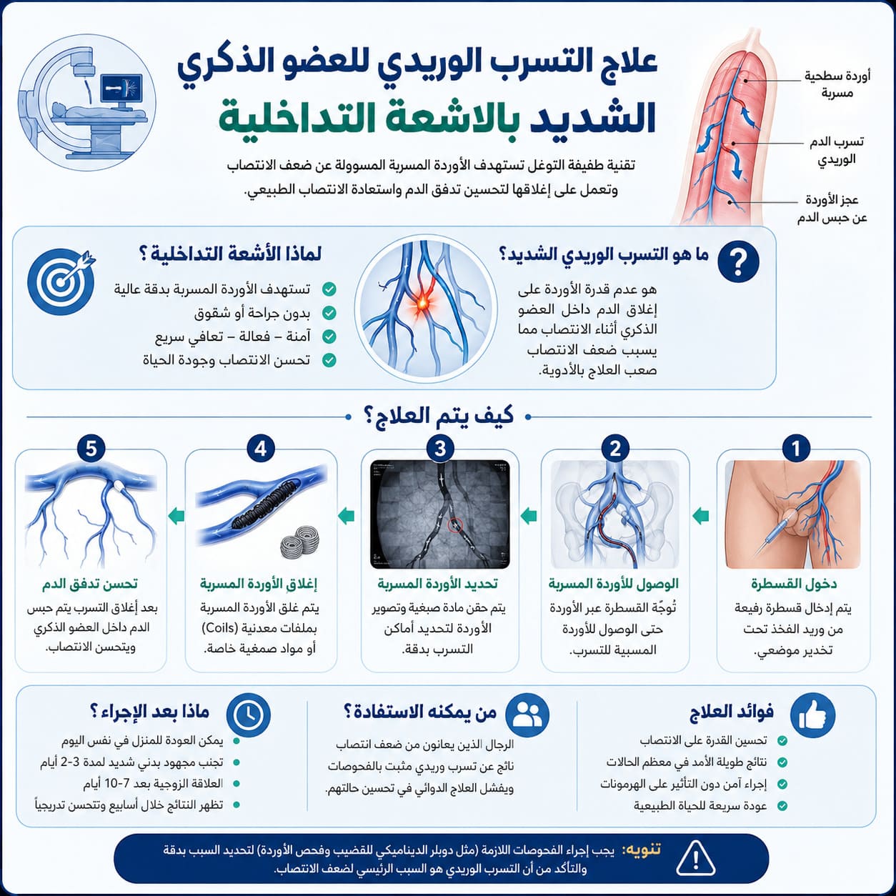 علاج التسرب الوريدي الشديد للعضو الذكري بدون جراحة